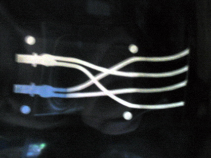 HighEnd-Tuning oder was ????? Röntgenbild Bi-Wiring-Adapter ( 358.-€ )